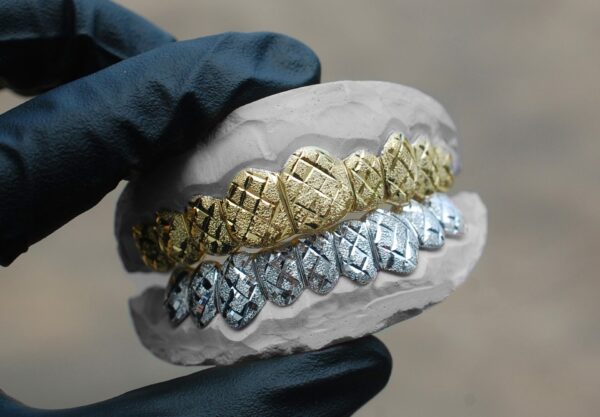 Yellow and White Gold Diamond Dust Cut Grillz