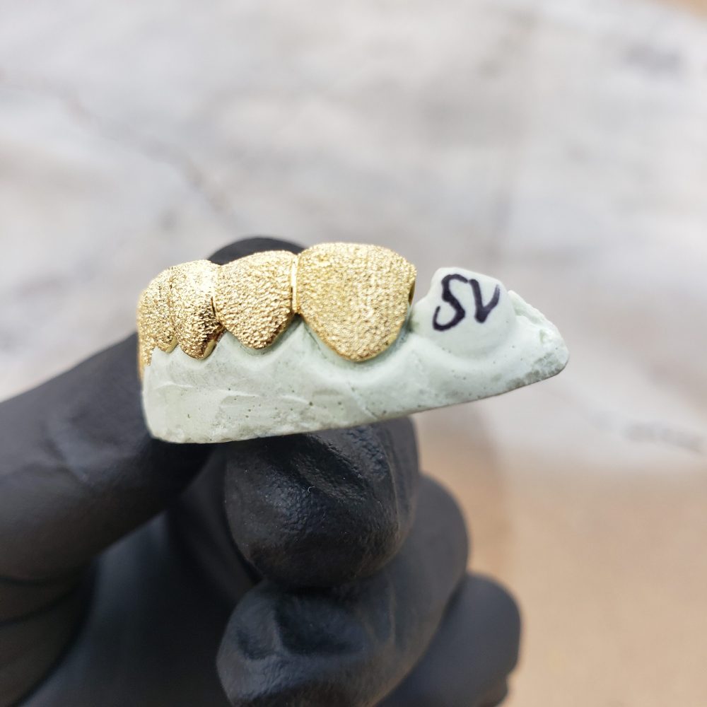 Yellow Gold Full Diamond Dust Grillz Get Custom Fit Grillz