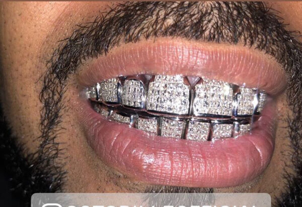 White Gold Invisible Set Princess Cut Diamond Grillz - GotGrillz