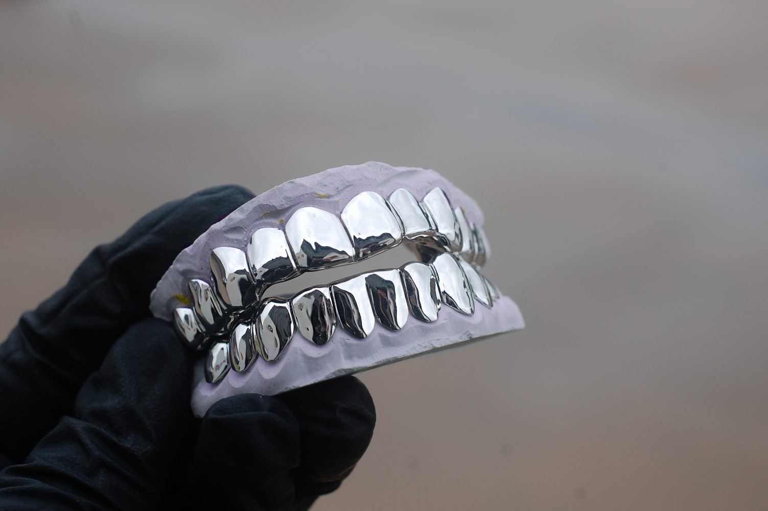 Need To Buy White Gold Grillz In Houston? Explore at GotGrillz