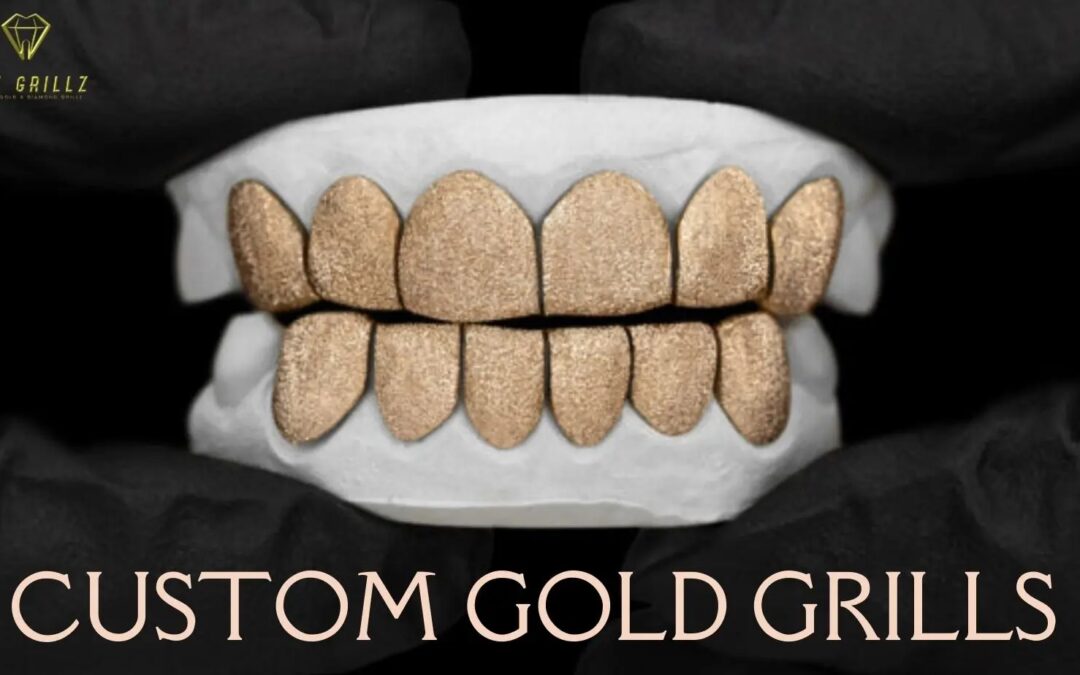 Custom Gold Grills in Houston Contact Now To Buy Online!