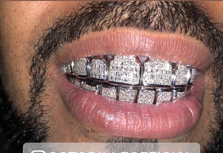How Much is a Diamond Grill?